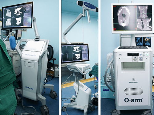 据了解,美敦力导航联合o型臂的技术,是目前全球最顶尖骨科智能导航和