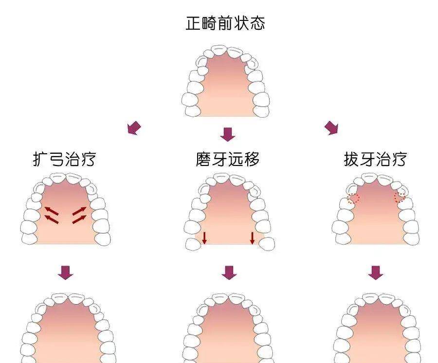 小天关晓彤是不是do脸了？凹脸变得幼态又平整