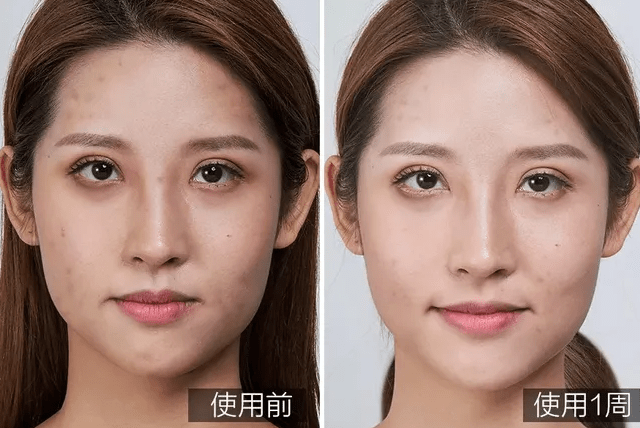 产品测评：美白淡斑产品哪款好？美白淡斑产品排行榜中，这两款，深受欢迎！