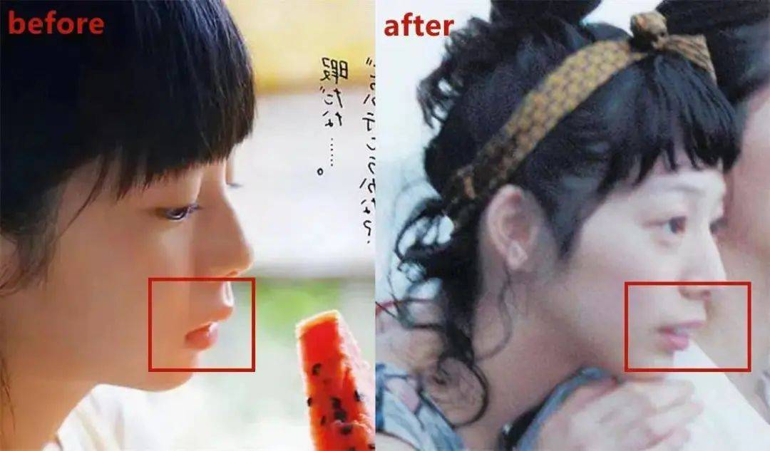 牙龈关晓彤是不是do脸了？凹脸变得幼态又平整！