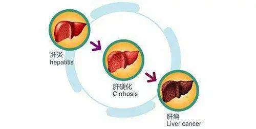 治疗|德开医药聊健康：乙肝小三阳是什么病？有哪些症状？