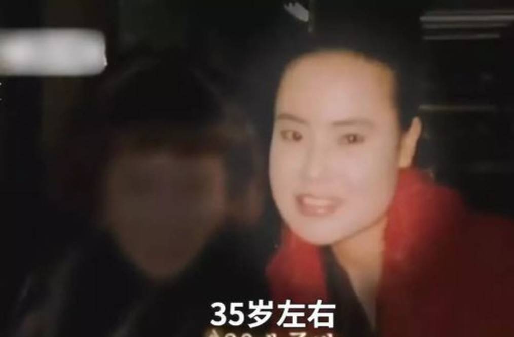 因为女星韩慧景：为了更漂亮，给脸注射食用油，把脸整成“猪头”