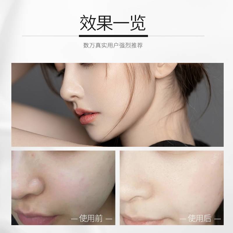姐妹问一下:护肤品祛斑哪个牌子好?