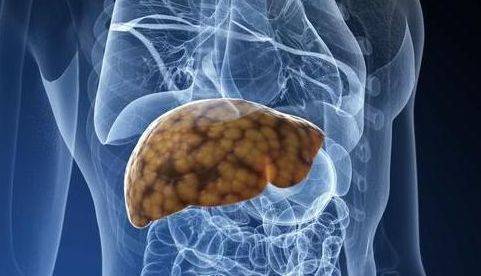 肝脏|肝脏好不好，竖起中指就知道了？专家们说实话，不妨自测一下。