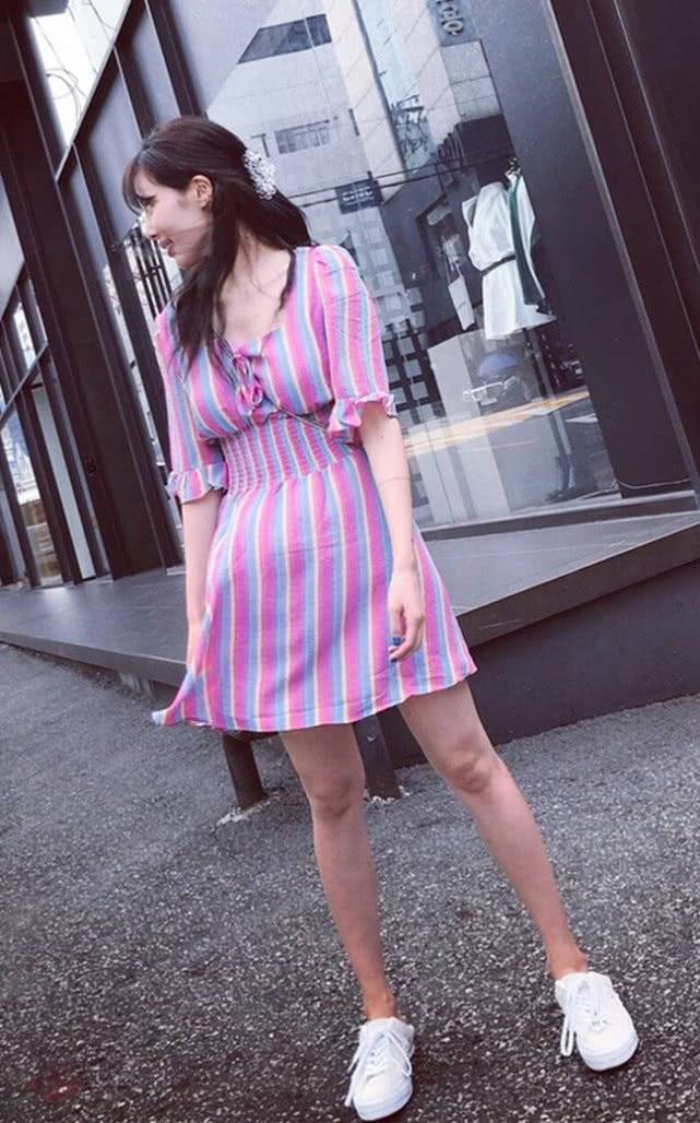 女王金泫雅颜值下降，纯素颜出镜嘴巴还肿得像吃了绝味，确定没丰唇？