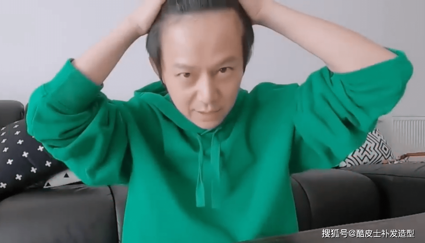 观点评论明星为了发际线有多拼？植发假发外加发际线粉，却败给胎毛王白鹿
