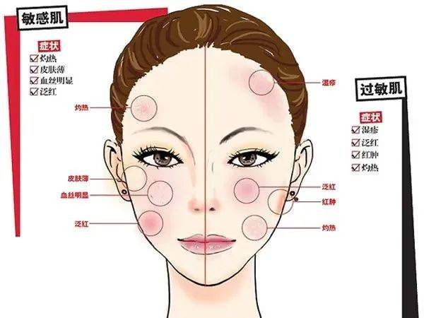 症状巧防“春敏”小妙招都在这里了，必须收藏！