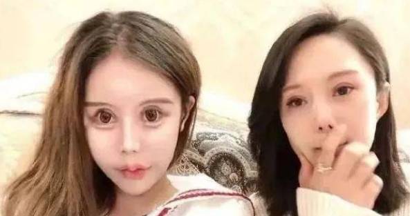 周楚娜“她用400万把女儿整成怪物”！第一批00后沉迷整容，父母是推手