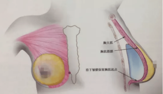 胸部美胸惹人爱，能够让你拥有完美胸型的项目大公开