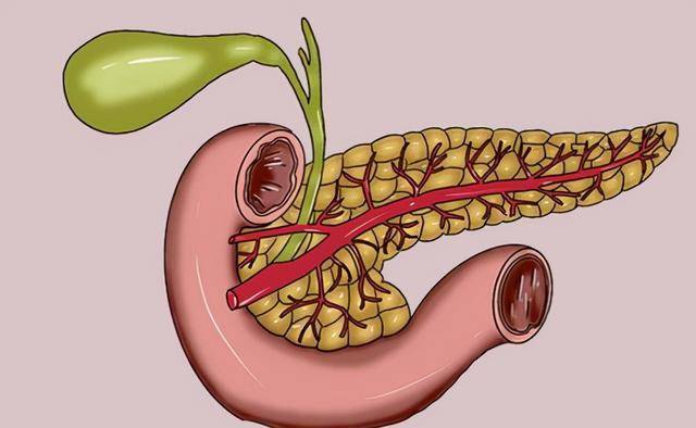 症状|以为是“胃病”，结果住进了ICU，胰腺炎究竟有多痛苦？