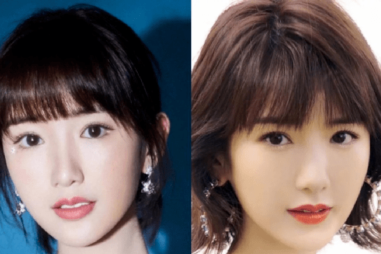 or成功减龄or发面馒头?女星热衷的饱满苹果肌,一不小心成“灾难”