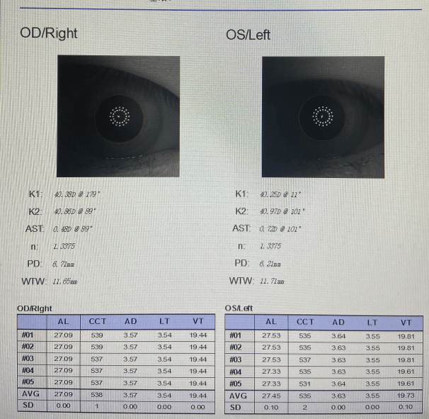 2021年5月,奶奶带着小泽来到了渥迪眼科,进行了全面的医学验光检查