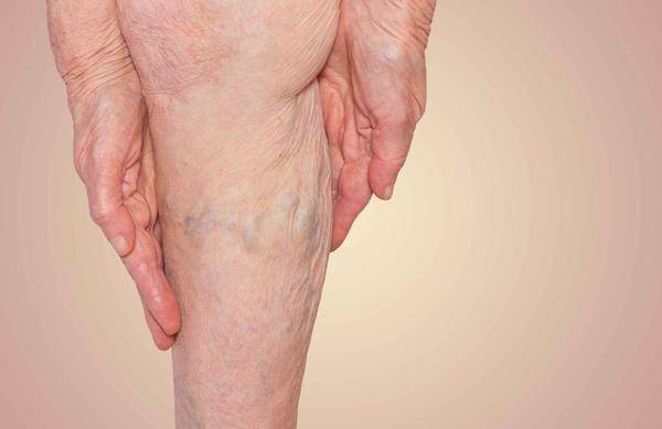 原创血管堵塞时身体这3处会有明显症状发现后要及时调理