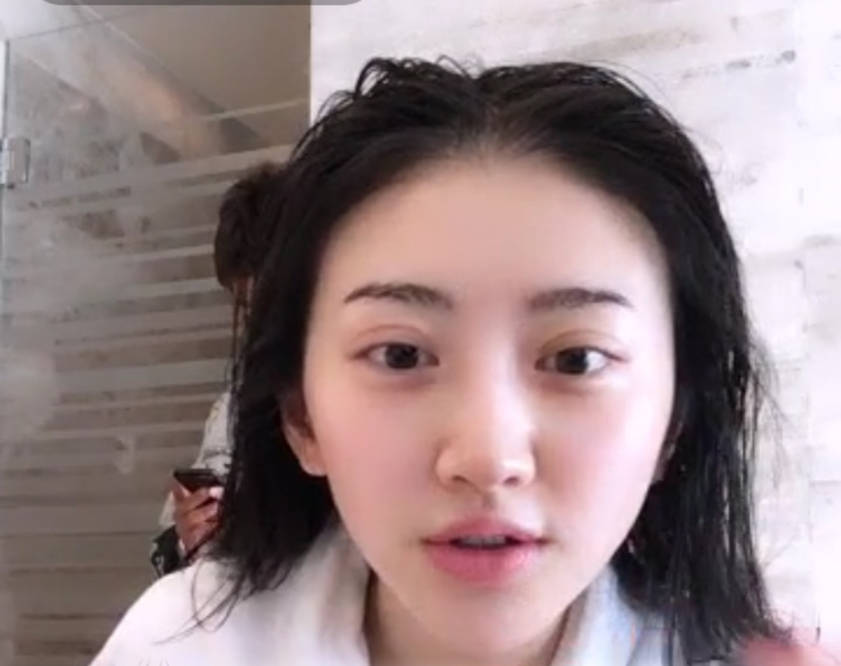 单眼皮女星割双眼皮如跨分水岭，没整好变“悲伤蛙”，成功则变气质美女？