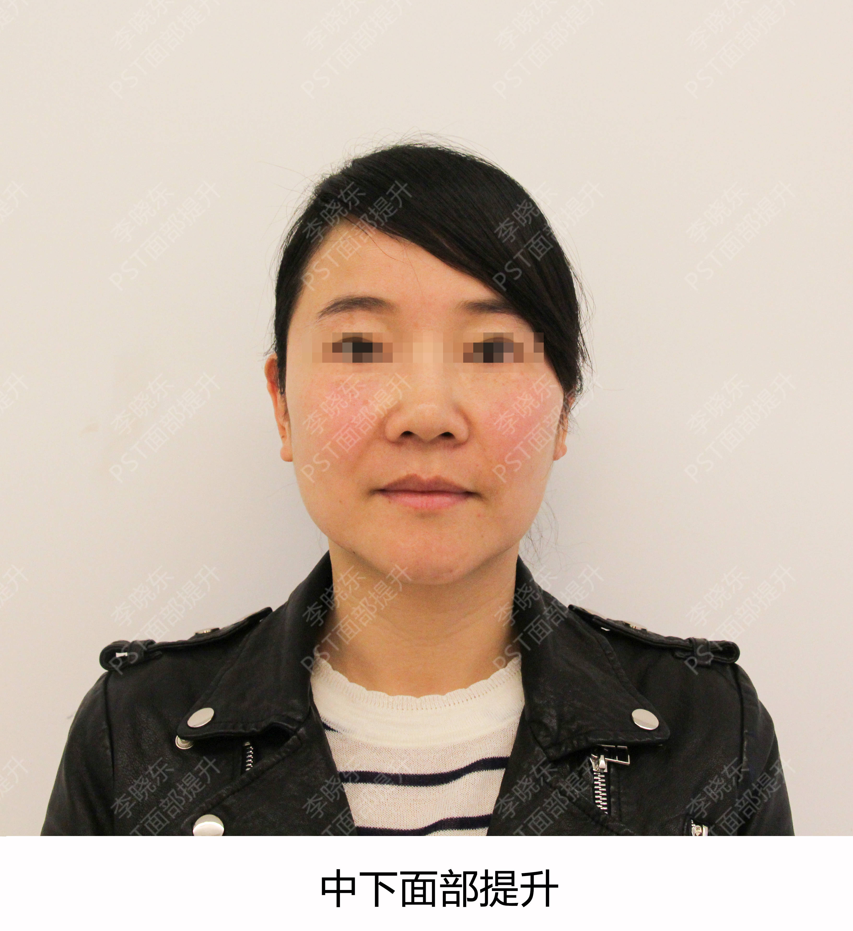 鱼尾纹警告!这7个坏习惯,让你的皱纹爬上脸