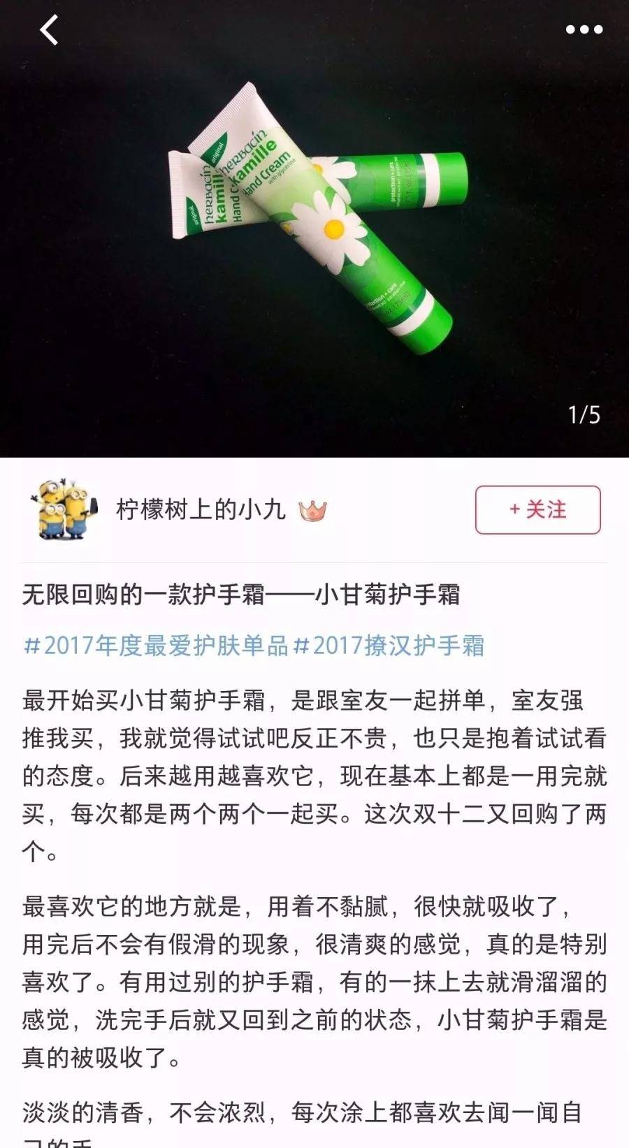 手部38岁谢娜参加活动，却被双手抢镜，网友：难怪张杰这么爱她