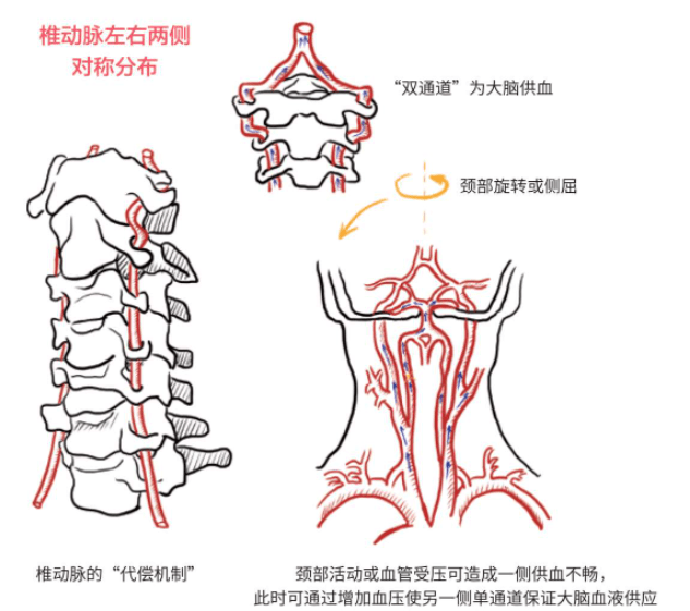 当颈部向一侧旋转或者侧屈的时候,就会把另一侧椎动脉拉长,使椎动脉变