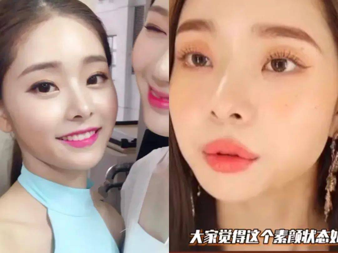 原创宋智雅的嘴唇算是丰唇失败的案例了吧