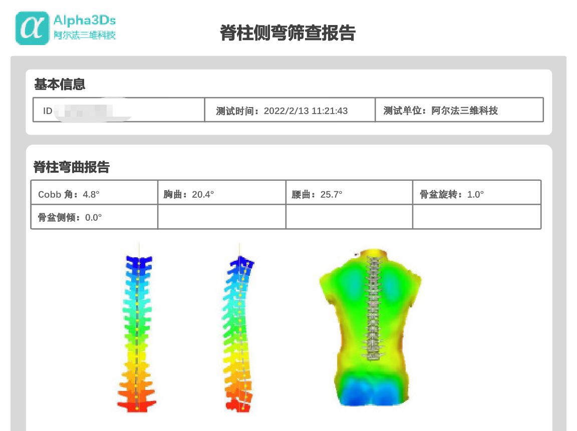 cobb角,胸曲,腰曲,盆骨旋轉和盆骨傾斜的度數sigma-1輸出的脊柱側彎