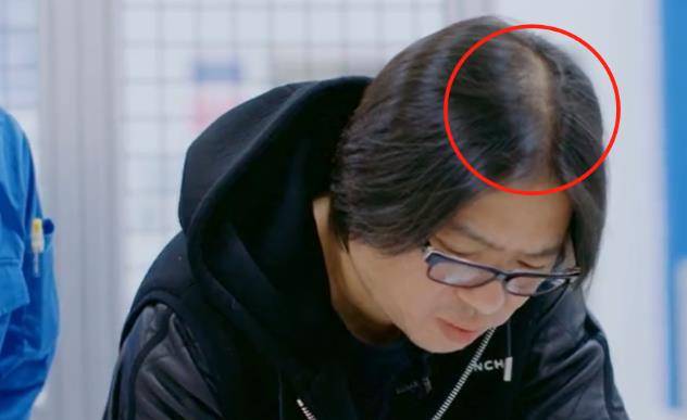 原创高晓松上山挖笋近照曝光头顶稀疏疑似脱发暴瘦30斤下巴变尖