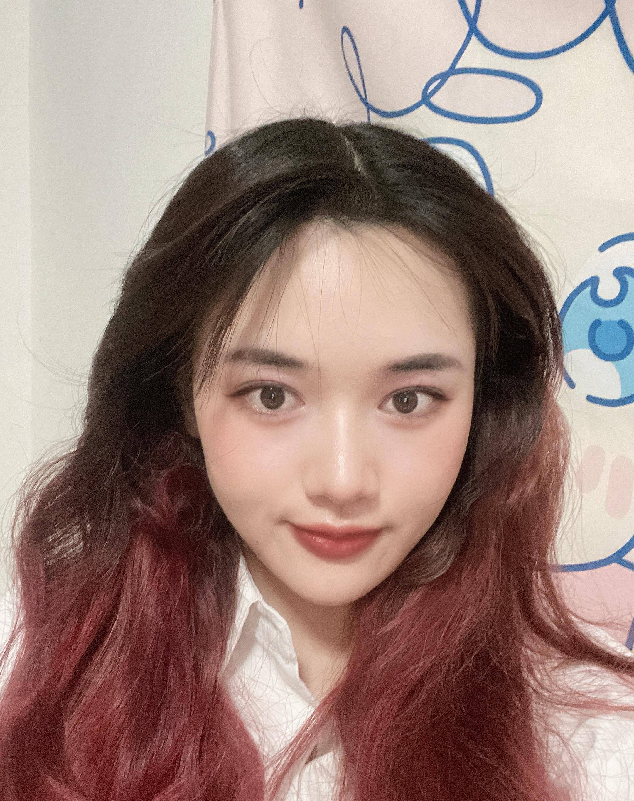 原创25岁小姐姐做完面部吸脂60天父母以为我悄悄换了一张脸
