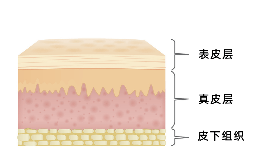 皮肤大致可以分为表皮,真皮,皮下组织三层.