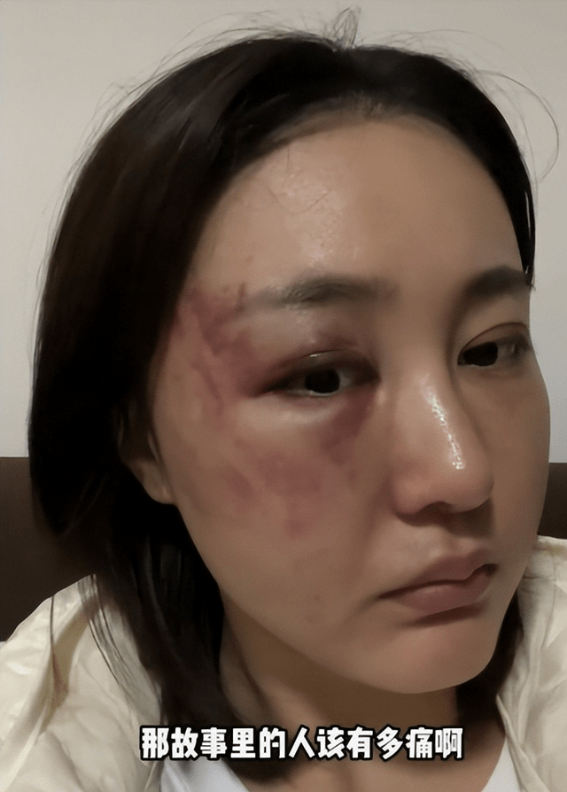 女网红举报老公家暴男方指责女方出轨究竟真相如何