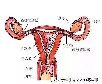 输卵管是女性内生殖器的组成部分,承担着人类孕育生命的重任.