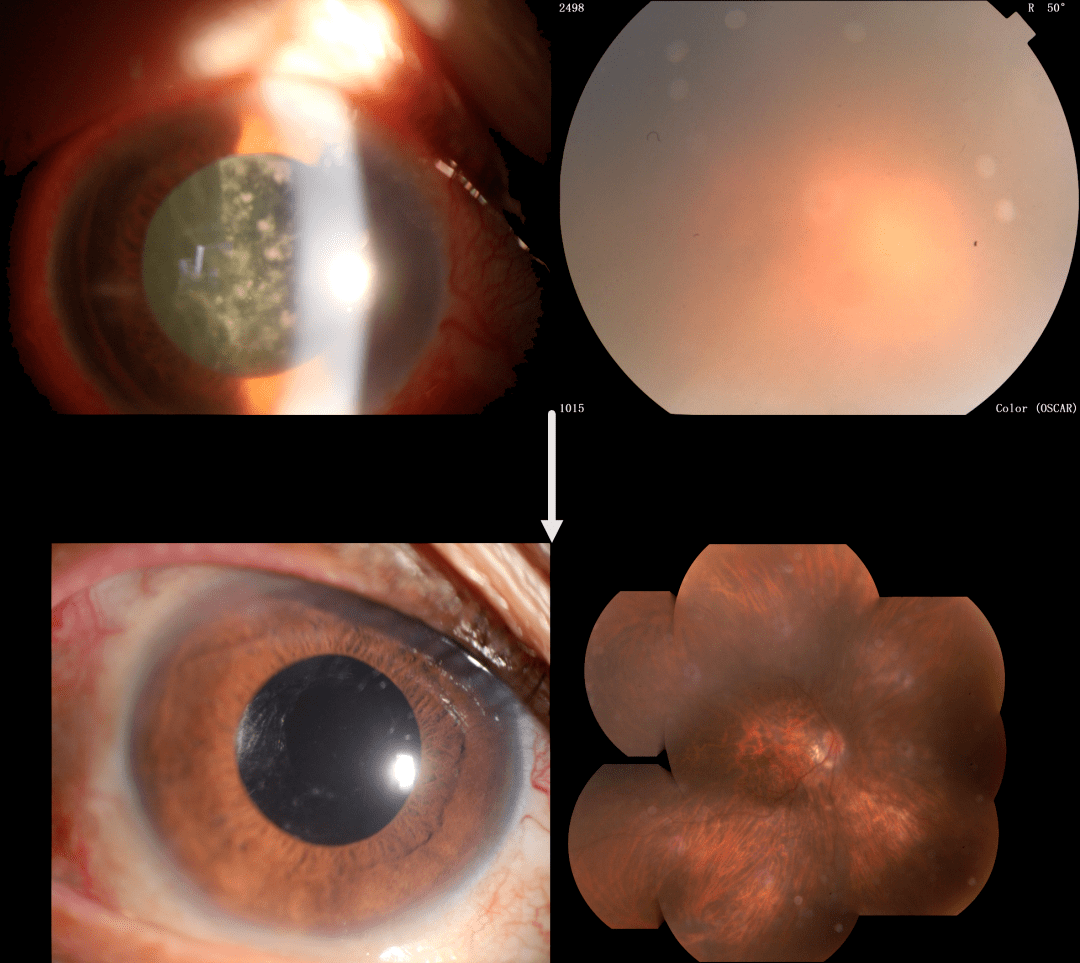 陶勇我想让眼睛只是眼睛不再长石头虫子蘑菇和牙齿