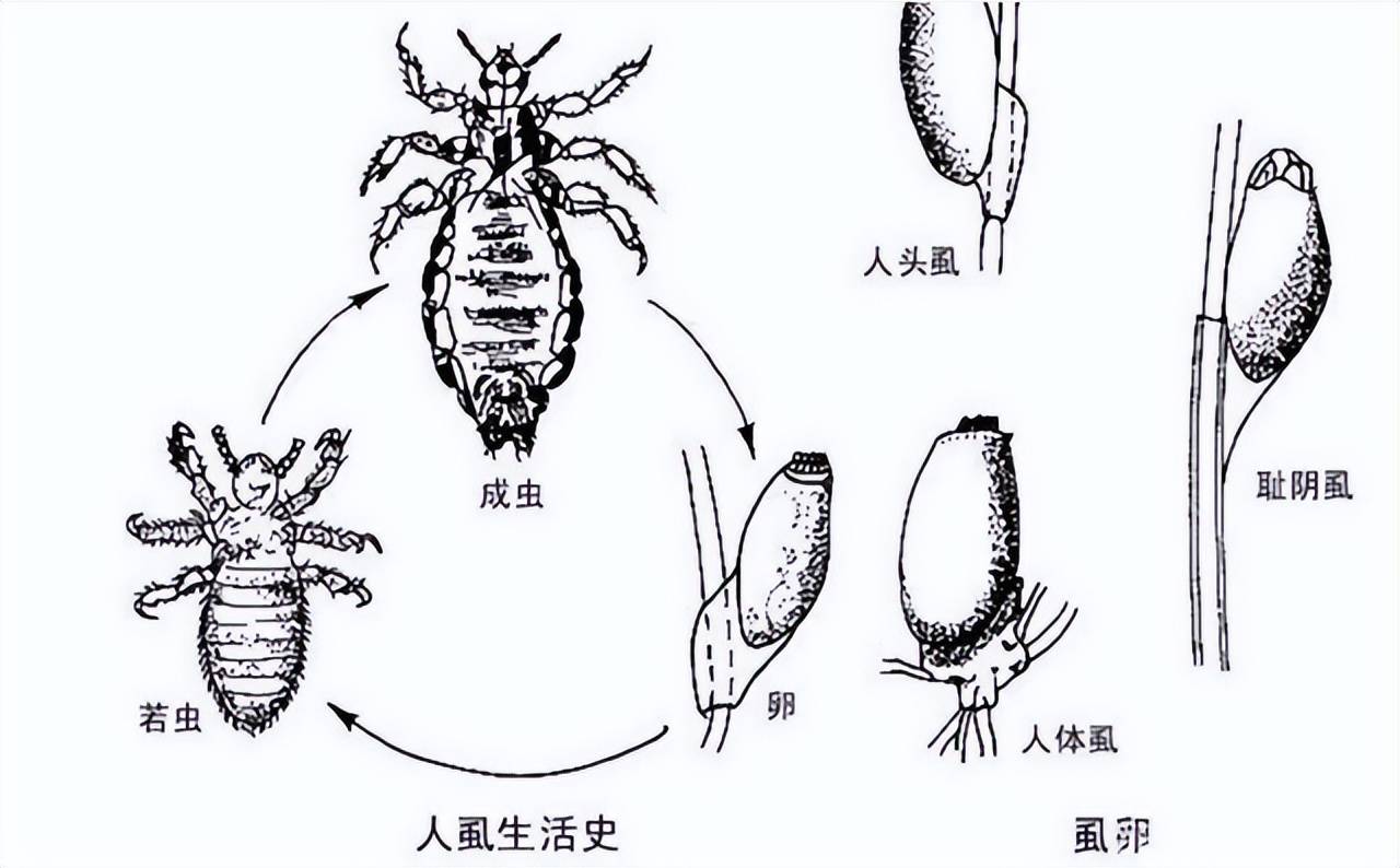 男人阴部长出虱子图片图片