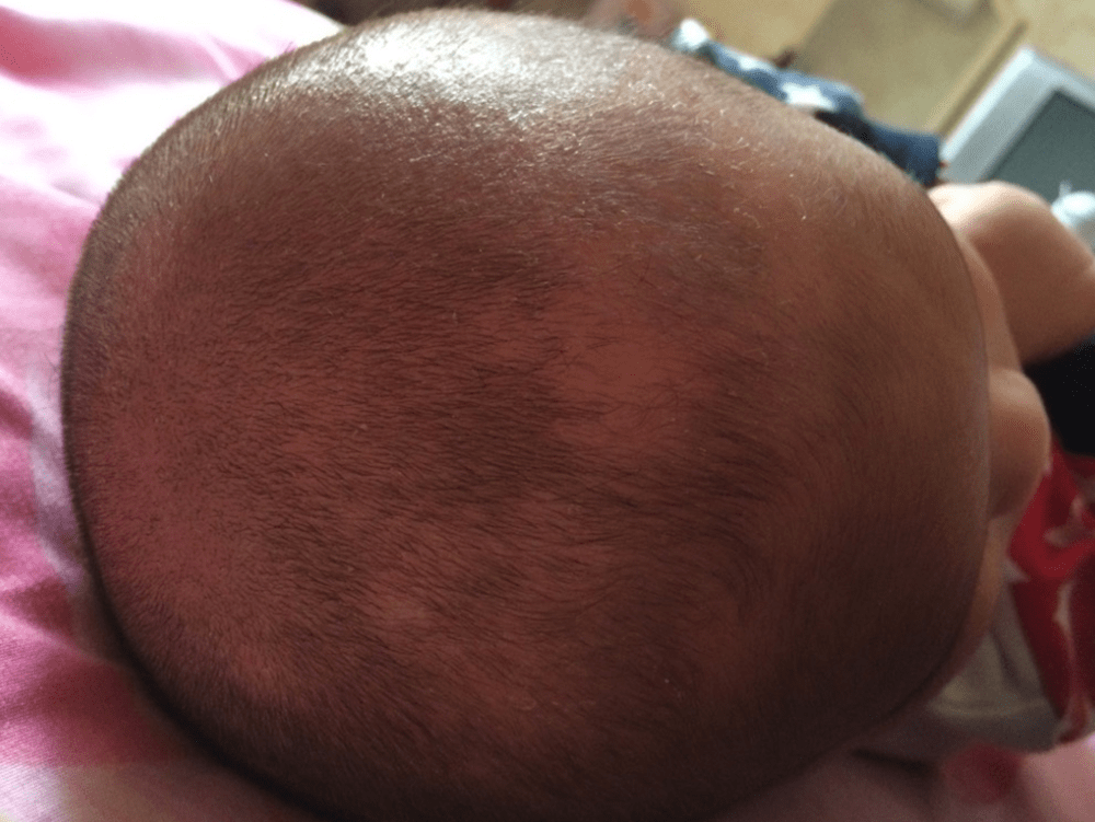 宝宝头发不均匀图片图片