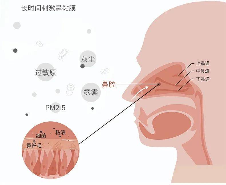 鼻塞原理 模拟图图片