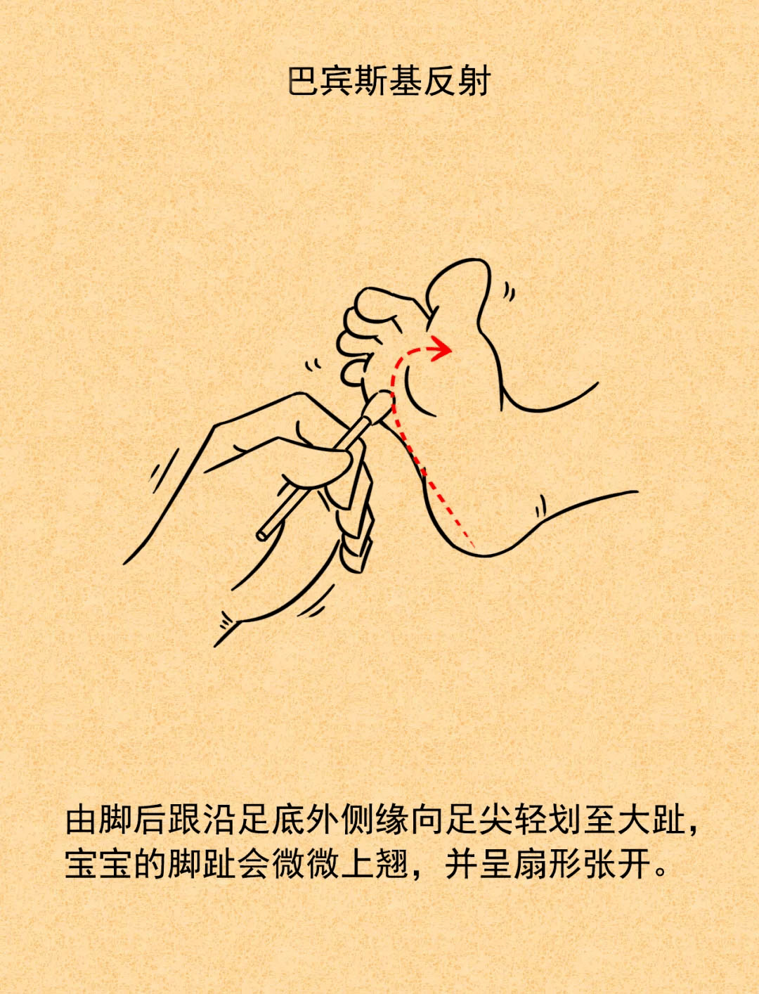 蜷缩反射图片