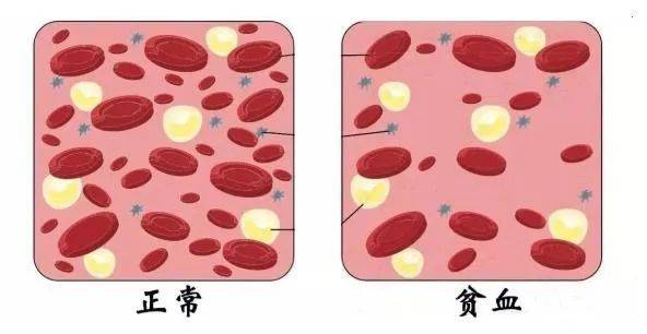 人體需要鐵來製造血紅蛋白,如果鐵元素不足,血細胞就會變得小而少.