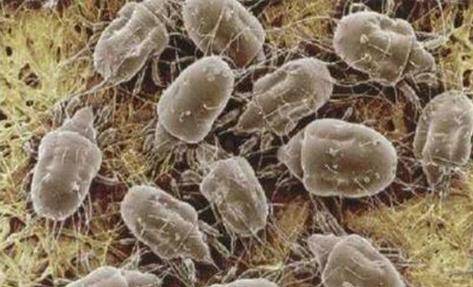 鼻子两旁挤出的白色物质是什么?鼻翼两侧的白色分泌物如何清除?