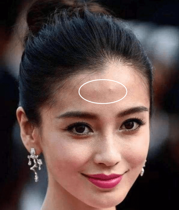 原创明星爆痘烂脸合集迪丽热巴的皮肤竟差到如此地步