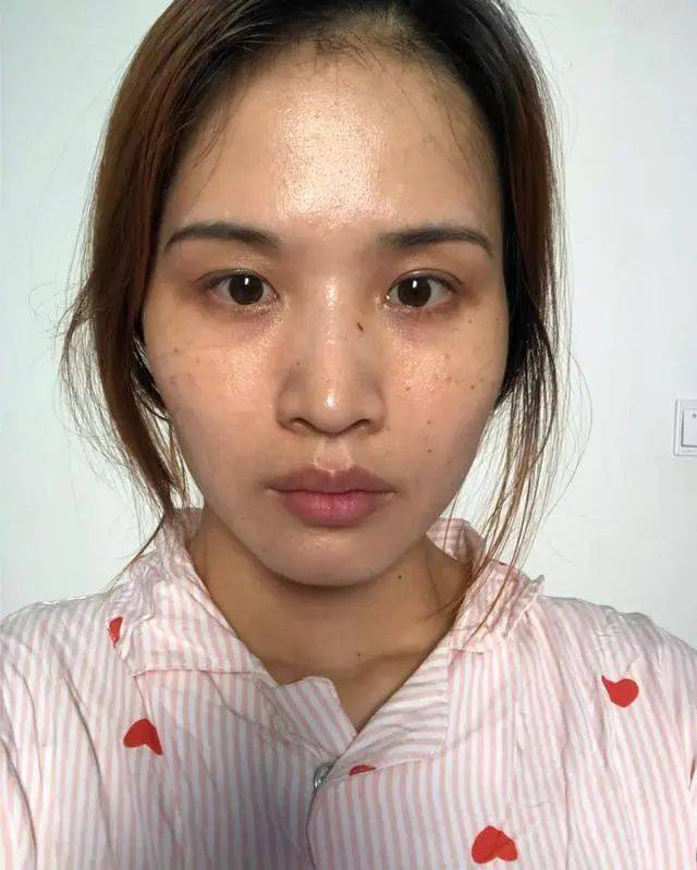 你的衰老程度是几级一级不明显三级状态更像40岁女人