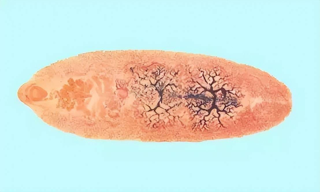 当姜片虫的幼虫进入体内后,就会导致肠黏膜坏死,脱落和炎症,溃疡等.