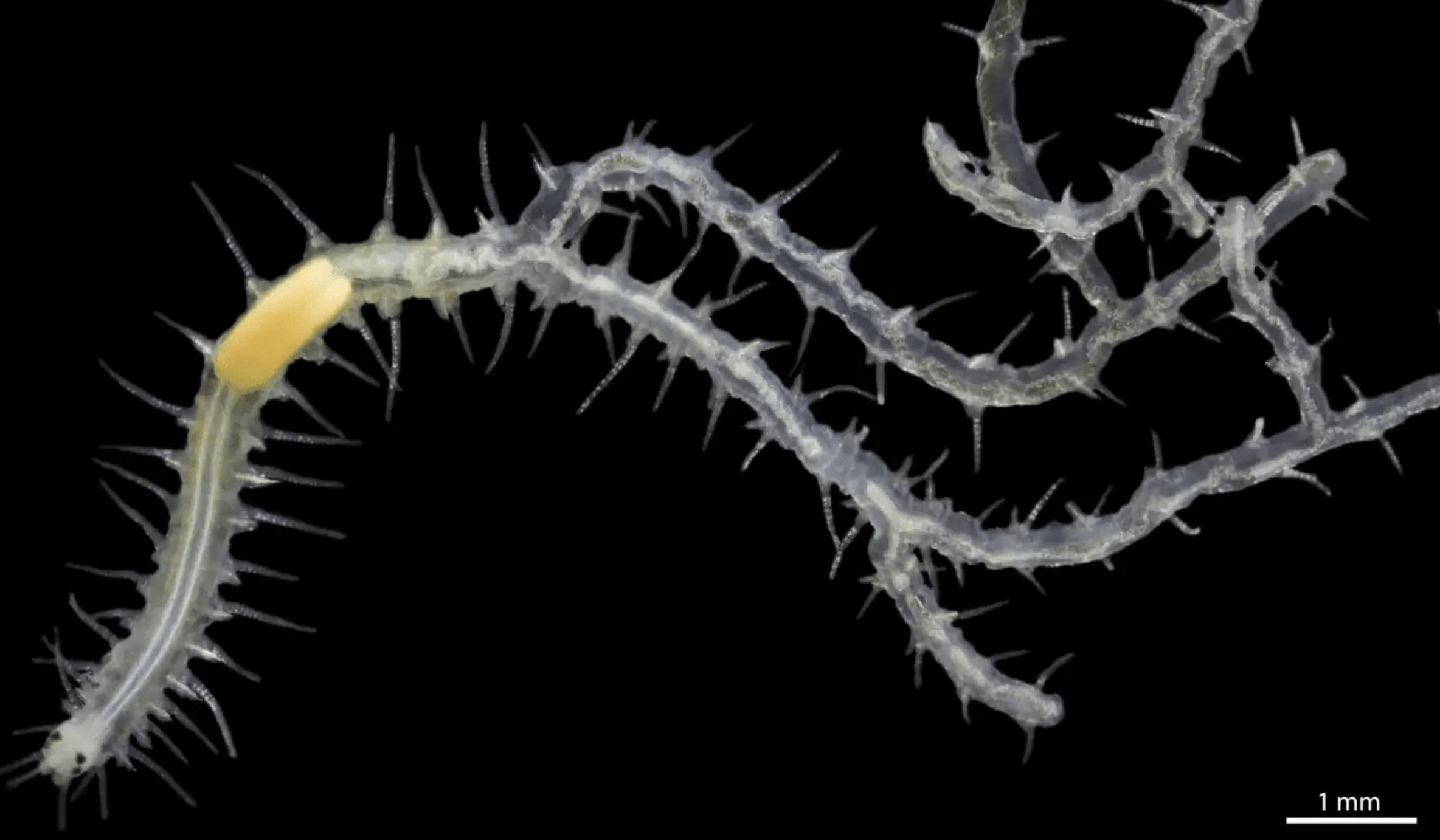 螺杆菌蠕虫图片
