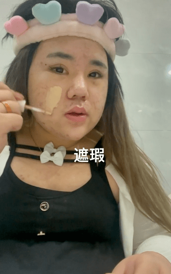 小霸宠被指撞脸满脸痘痘的男网红,气到一晚上没睡