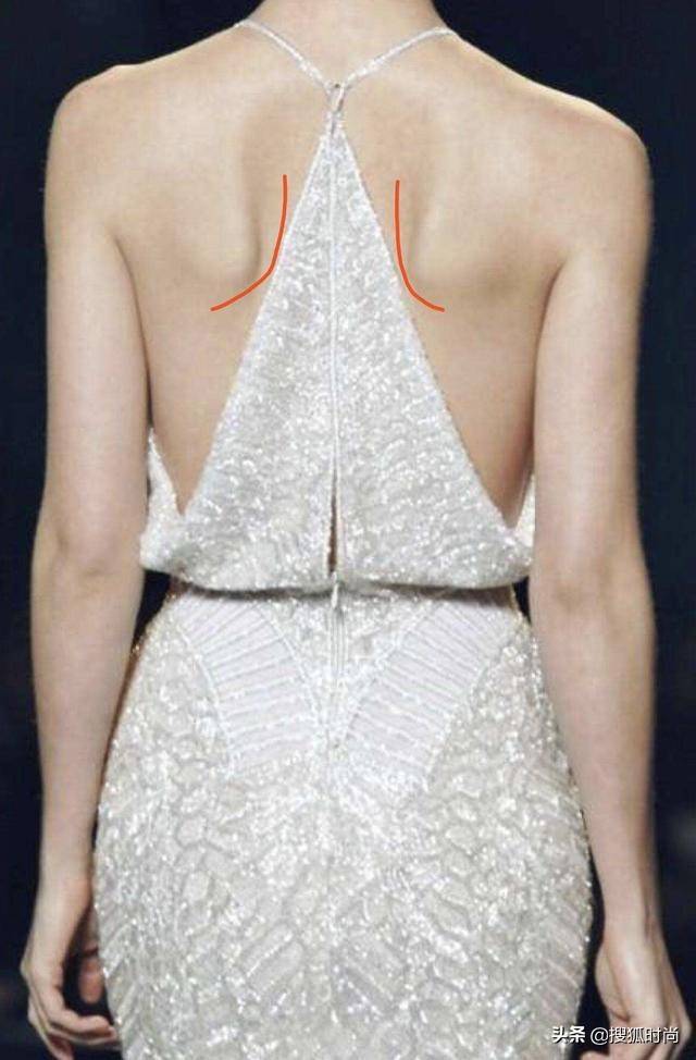 迪丽热巴蝴蝶背又上热搜,你追求的"骨感美"其实是畸形美学_肩胛_影响