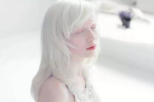 最严重的莫过于白化病,不仅头发是白的,连眉毛甚至体毛都是白的