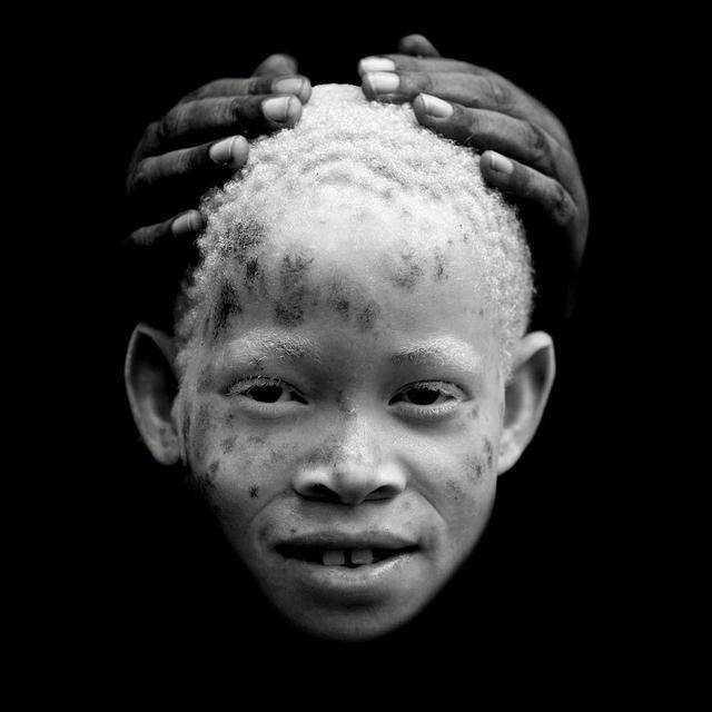 原创在非洲白化病人被巫医猎人围猎被父母抛弃遭遇招招致命