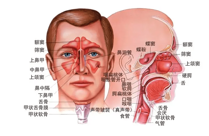 流膿涕就是鼻竇炎嗎這裡告訴你答案