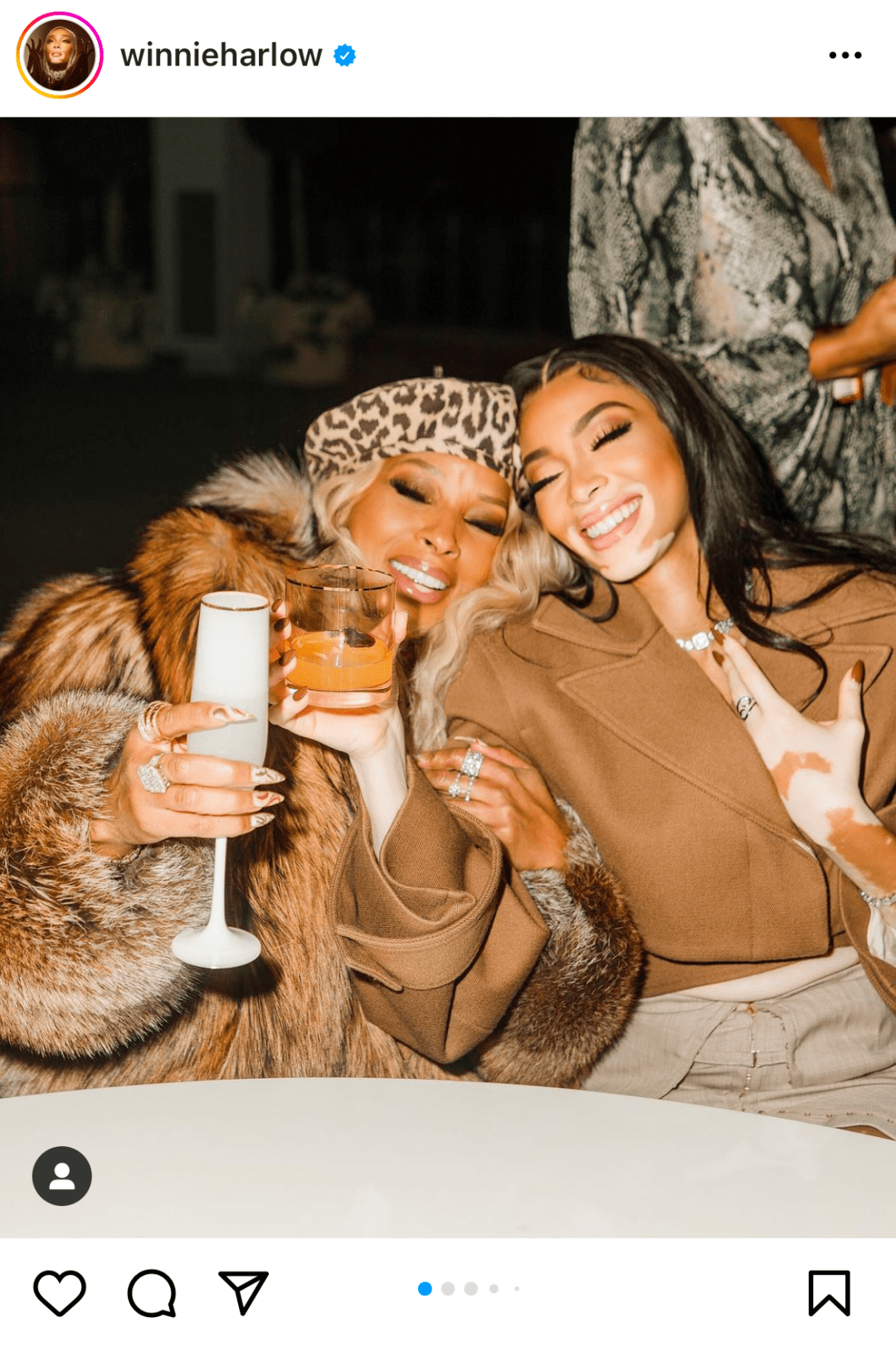 白癜风超模,独特的美胜过千篇一律_winnie_皮肤_治疗