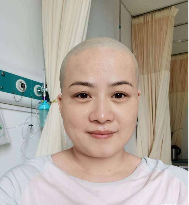 照片中的郑敏剃了光头,身穿医院里的病号服,不过看起来状态很好.