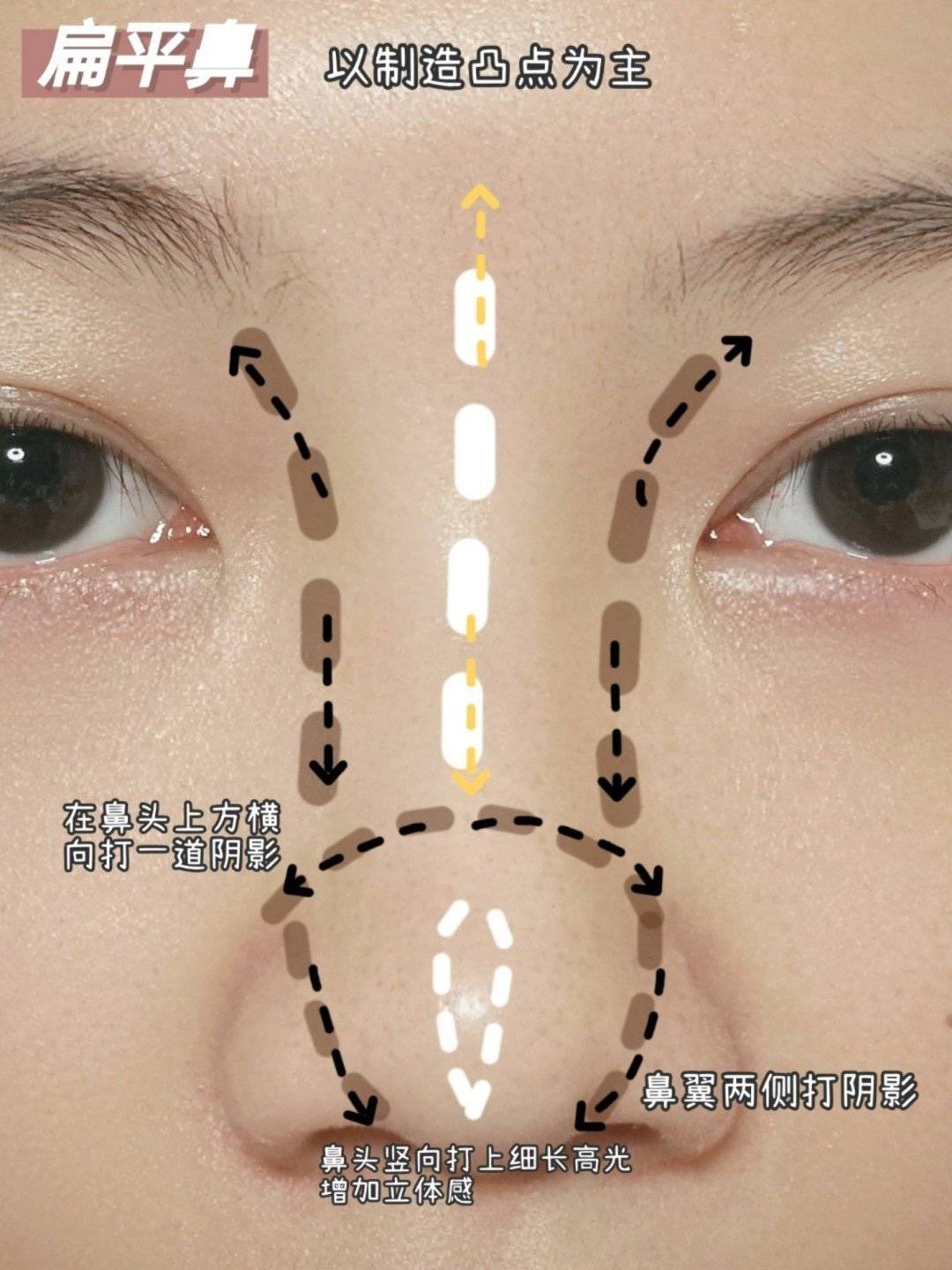 隆鼻重修二次隆鼻-精緻秀氣鼻型案例分享-韋志曄醫師
