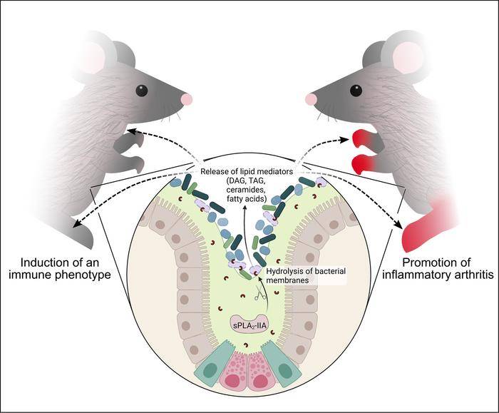 国际最新研究肠道菌群与关节炎等慢性炎症性疾病有关