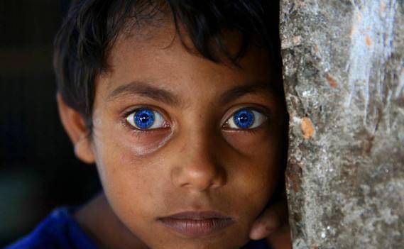 3,蓝色的眼睛拥有银色眼睛的人极少,如果从远距离看这类人像盲人的