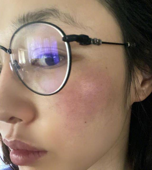 白百何脸部被晒伤,晒黑脸自拍照超自信,37岁的皮肤状态让人看呆_女
